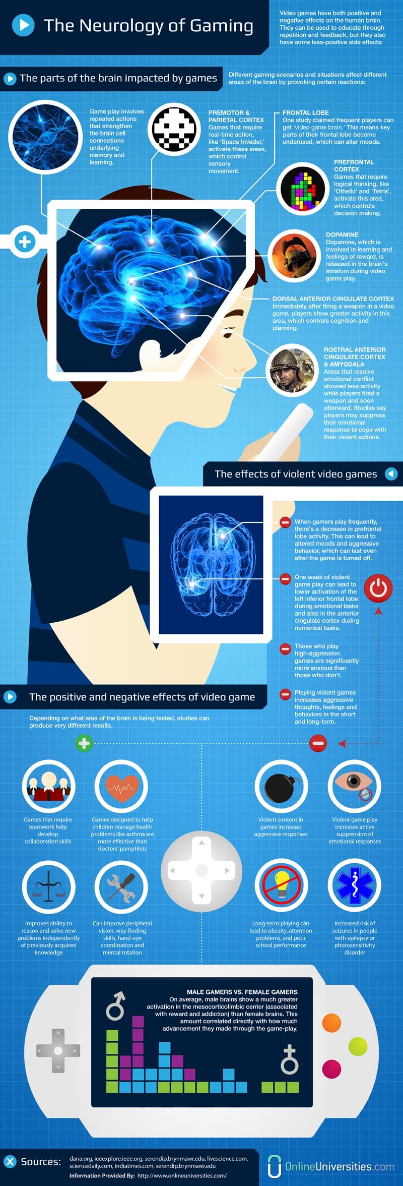 Does gaming mess with your head? The neurology infographic