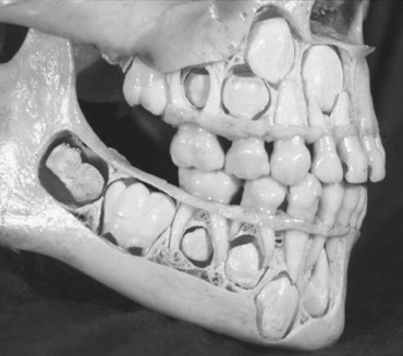Skull teeth