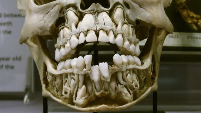 Teeth in jaw